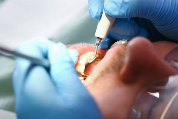 Best Emergency Treatment for Oral Infections in Wescosville, PA